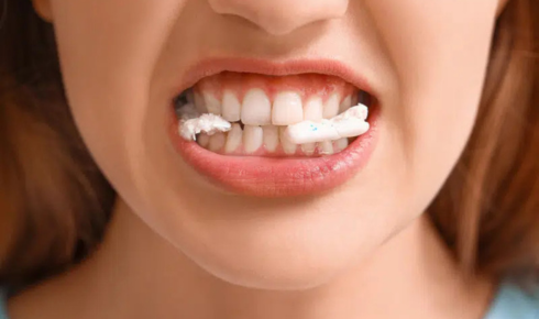 How Sugar-Free Gum Helps Your Teeth and When It’s Actually Useful