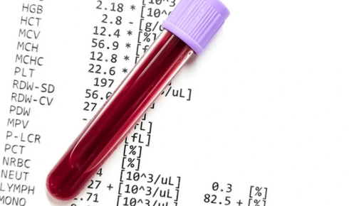 CBC (Complete Blood Count)